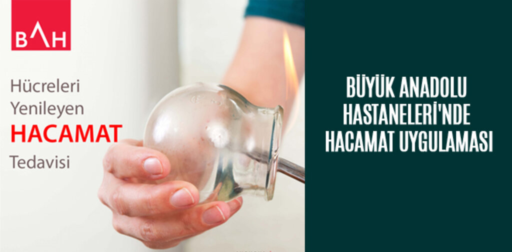 BÜYÜK ANADOLU HASTANELERİ'NDE HACAMAT UYGULAMASI