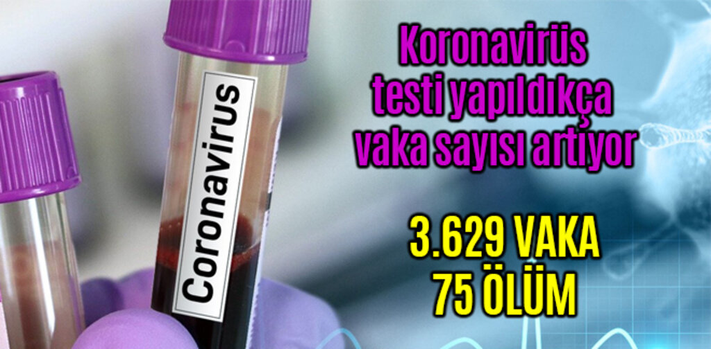 Koronavirüs testi yapıldıkça vaka sayısı artıyor