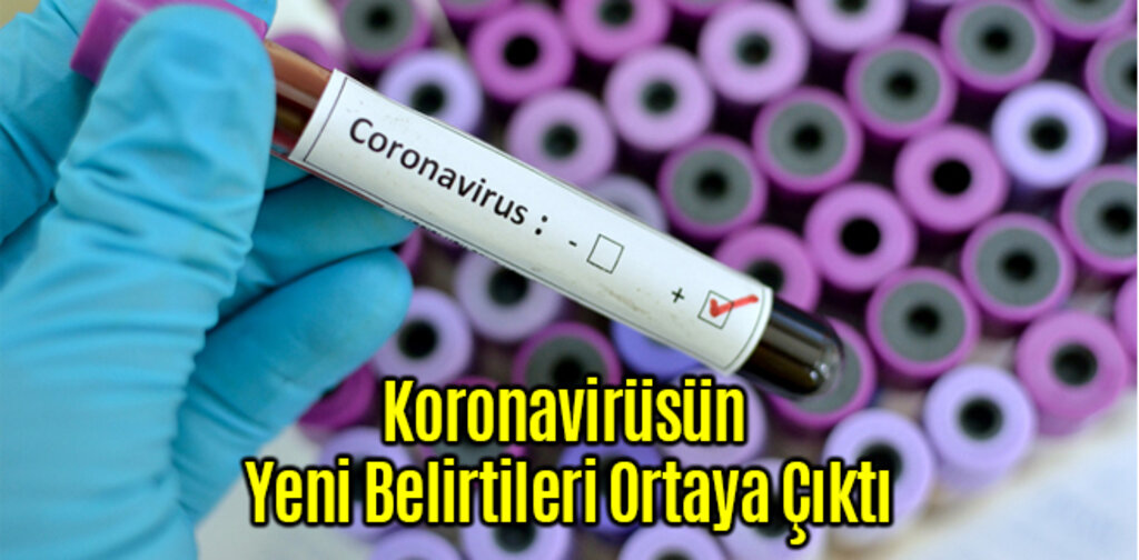Koronavirüsün Yeni Belirtileri Ortaya Çıktı
