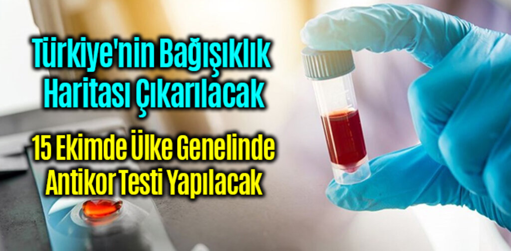 Türkiye'nin Bağışıklık Haritası Çıkarılacak