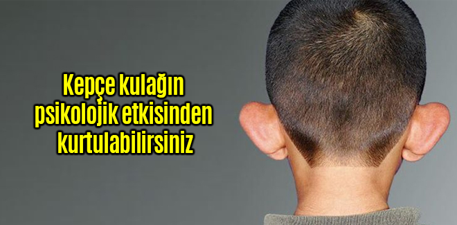 Kepçe kulağın psikolojik etkisinden kurtulabilirsiniz