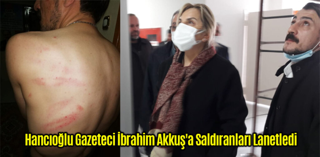 Hancıoğlu Gazeteci İbrahim Akkuş'a Saldıranları Lanetledi