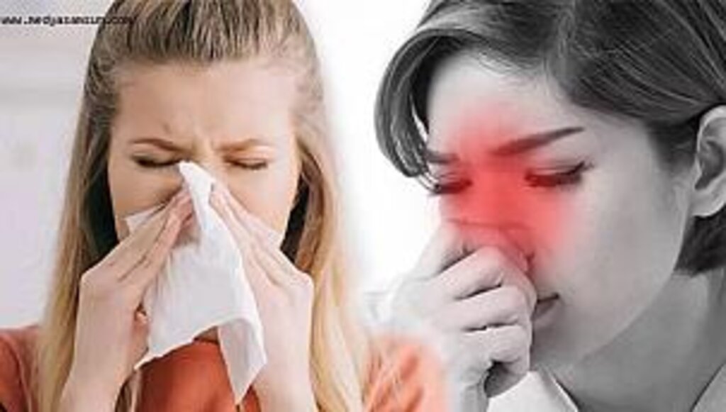 Alerjik Rinit (Saman Nezlesi) nedir, tedavisi nasıl yapılır?