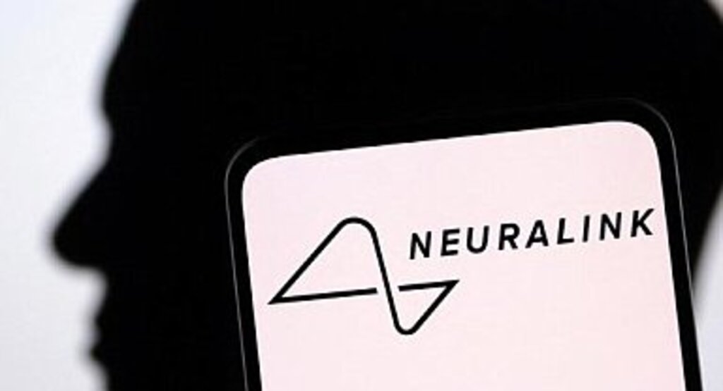 İnsan Beynine İlk Çip Takıldı 