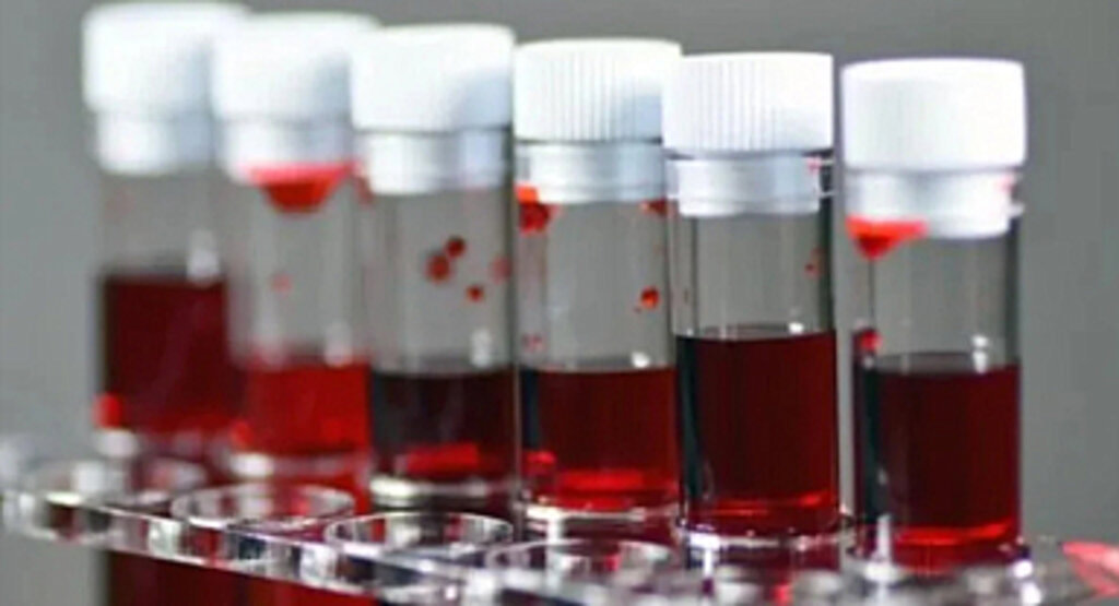 En sinirli kan grubu belirlendi