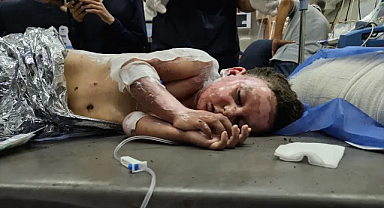 Katil İsrail, Gazze'de yardım için toplanan çocukları vurdu