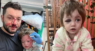 Komşu dehşeti: 14 aylık kız çocuğunu darp ettiler