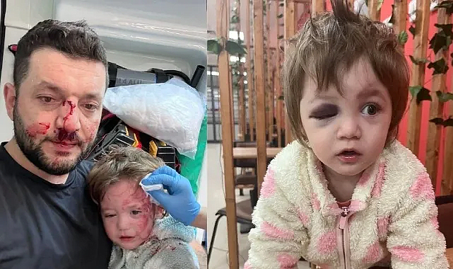 Komşu dehşeti: 14 aylık kız çocuğunu darp ettiler