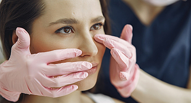 Samsun Burun Estetiği Öncesi ve Sonrası